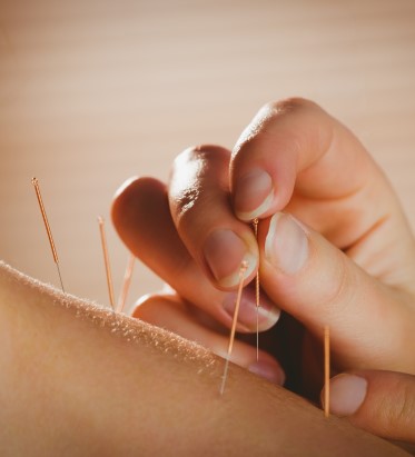 Acupuncture Clinic Guillaume Levesque Beresford